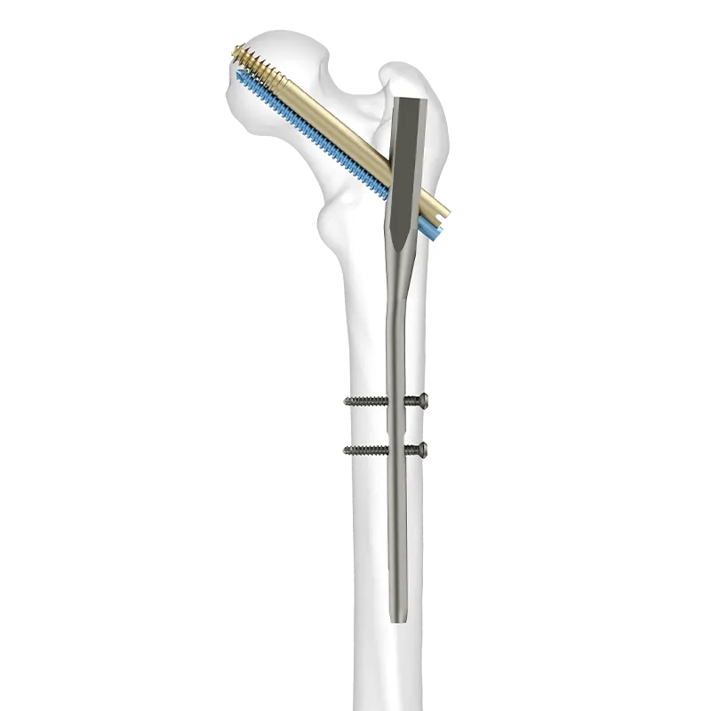 durofix-Intertan-Nailing-System