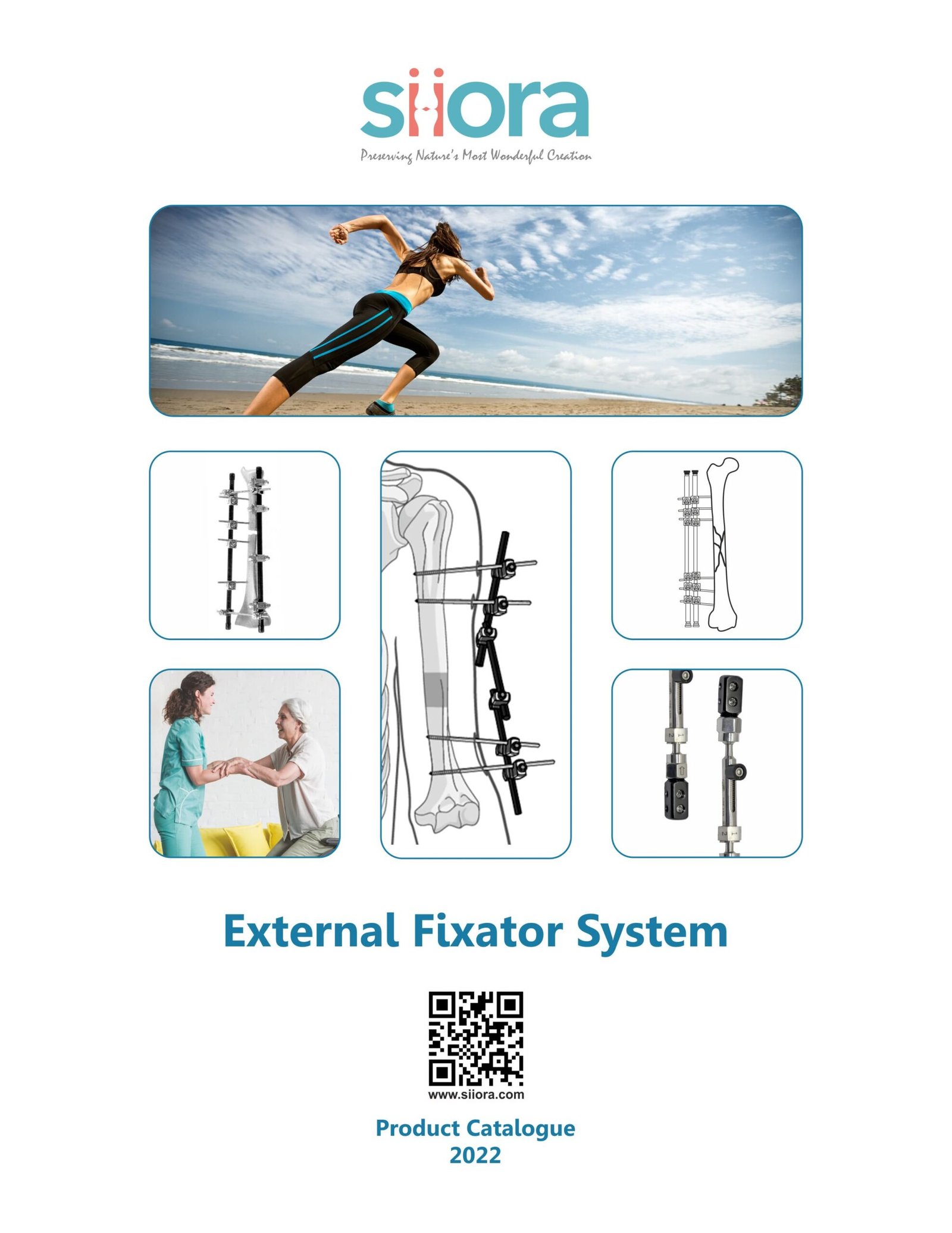 external fixator system