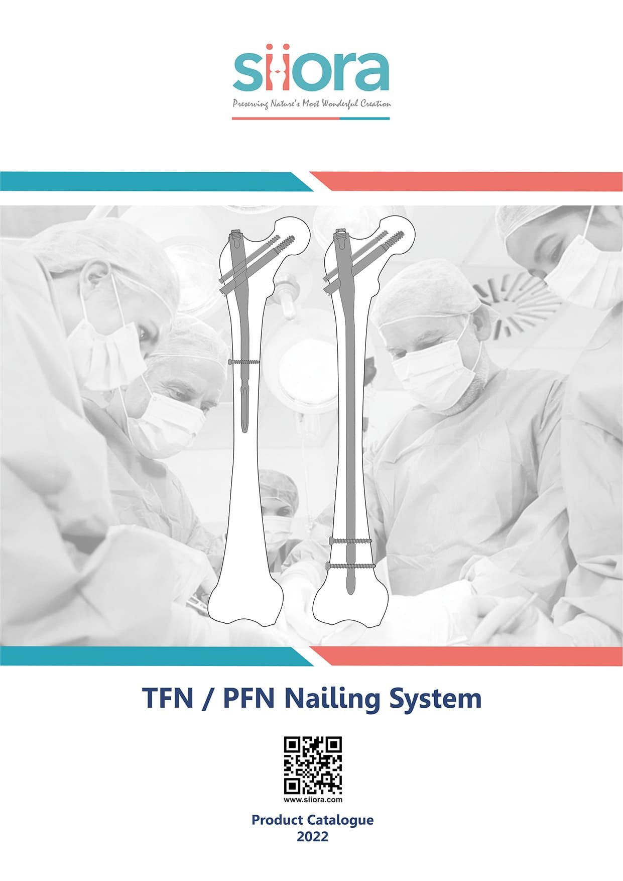 tfn pfn nailing system