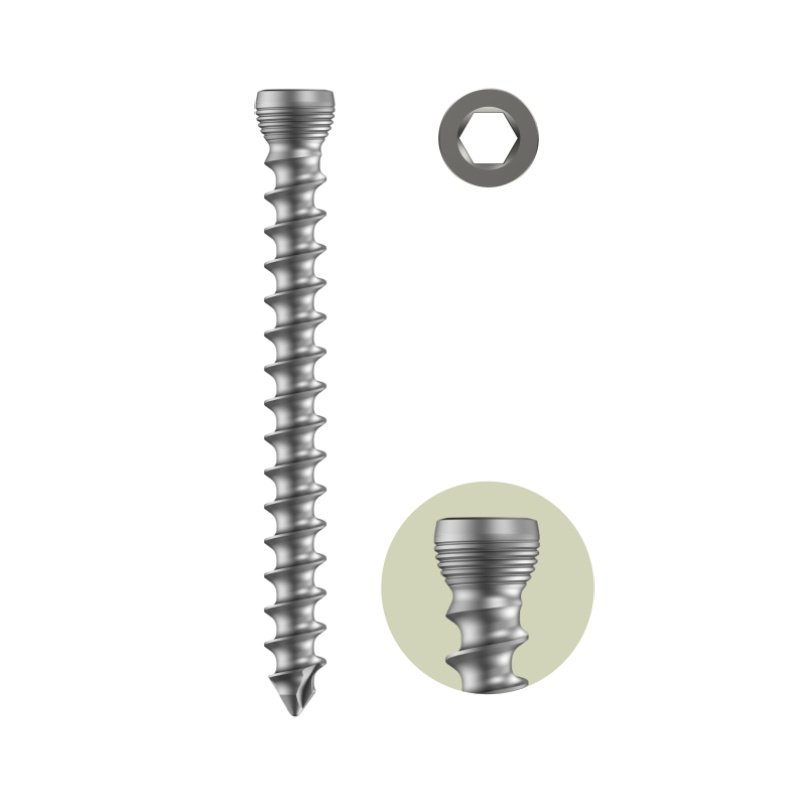 5.0mm Variable Angle Locking Head Cancellous Screw Full Thread - Self Tapping (HEXDRIVE)