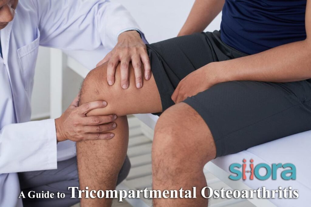 A Guide to Tricompartmental Osteoarthritis