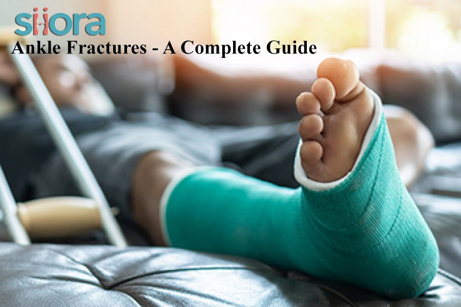 Ankle Fractures - A Complete Guide