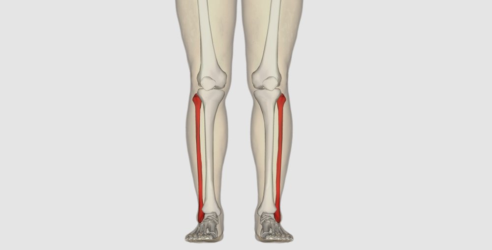 Fibula Fractures Types Symptoms & Treatment