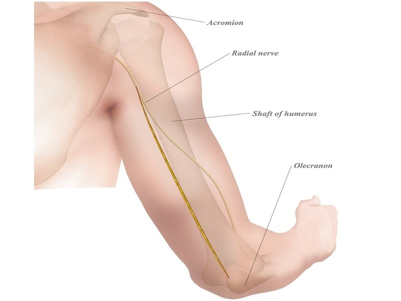 Mid-Shaft Humerus Fracture Treatment
