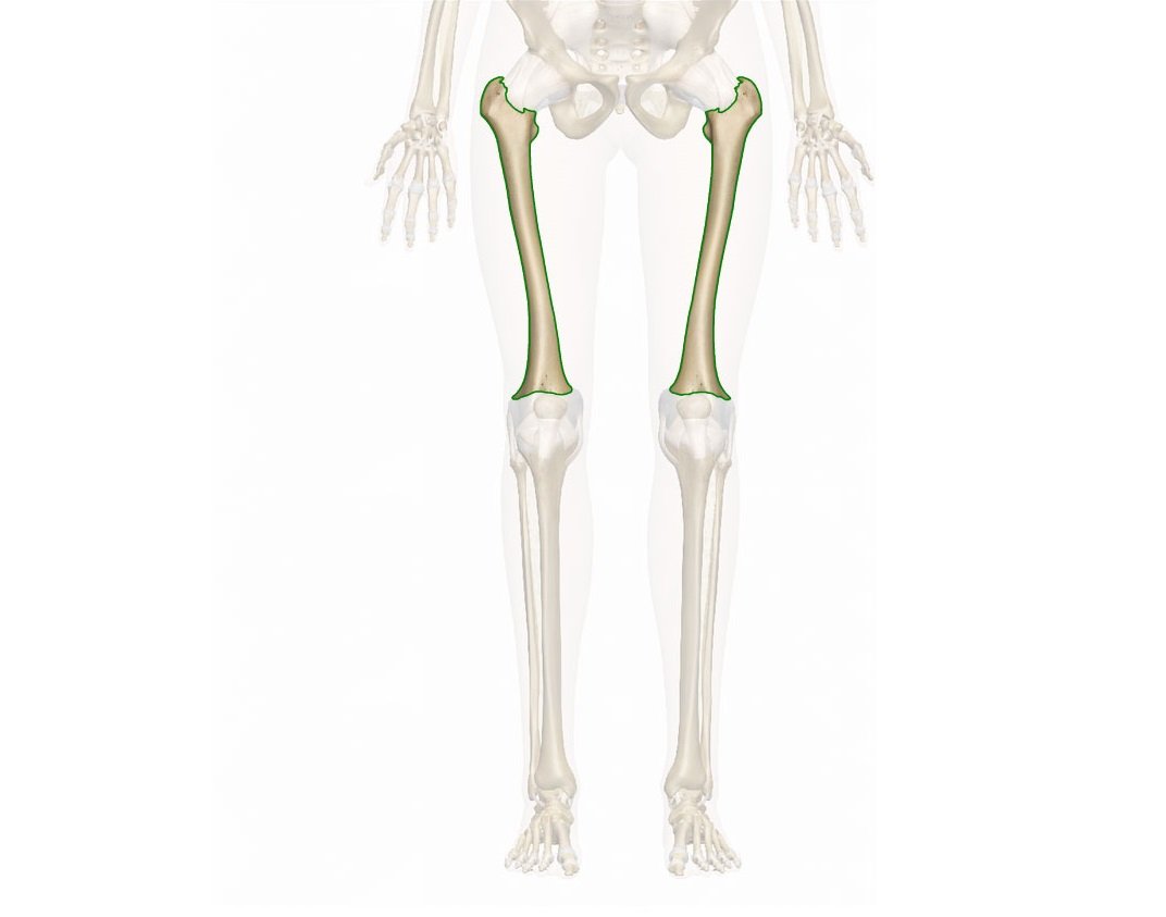 Pediatric Femur Fractures Treatments