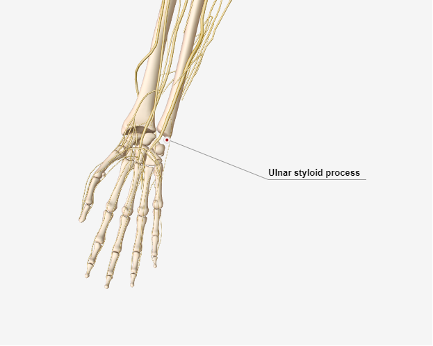 What Is an Ulnar Styloid Fracture