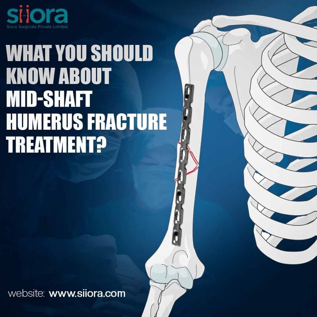 hemurus fracture