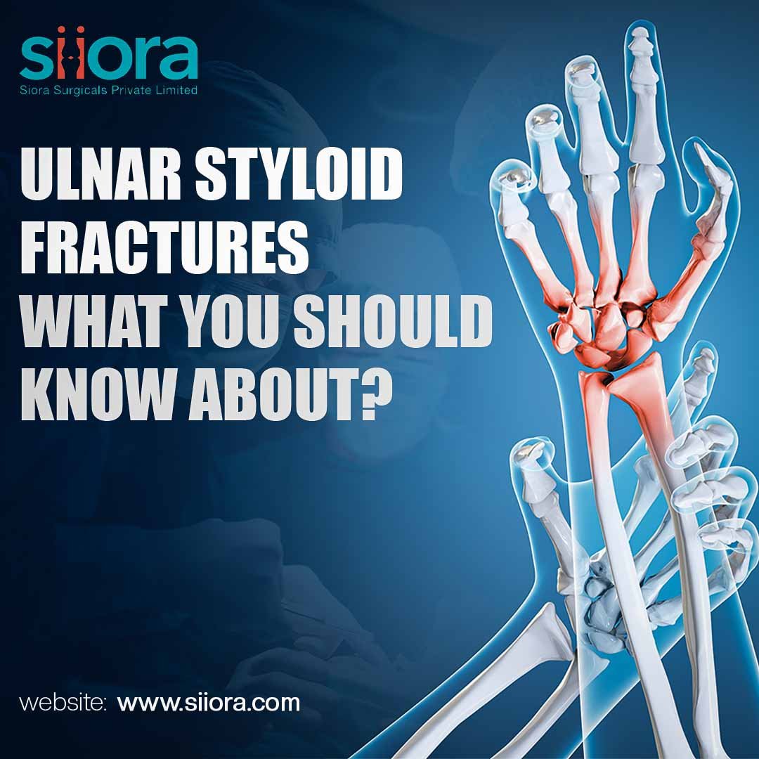 ulnar styloid fracture
