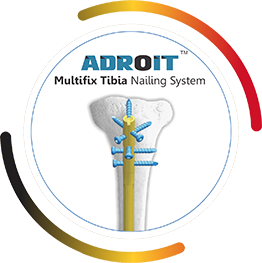 ADROIT Multifix Tibia Nailing System