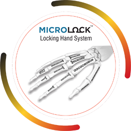 MICROLOCK Locking Hand System