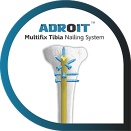 ADROIT Multifix Tibia Nailing System