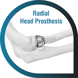 Radial Head Prosthesis