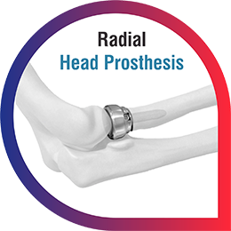 Radial Head Prosthesis