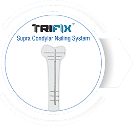 TRIFIX Supra Condylar Nailing System