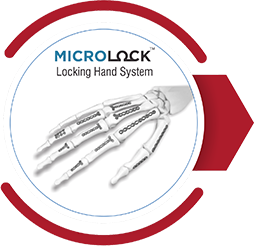 MICROLOCK Locking Hand System