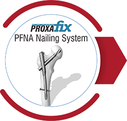 PROXAFIX PFNA Nailing System