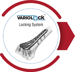 VARIOLOCK Locking System