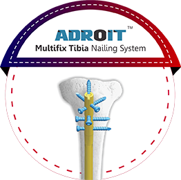 ADROIT Multifix Tibia Nailing System