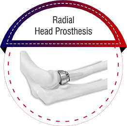 Radial Head Prosthesis