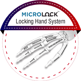 MICROLOCK Locking Hand System