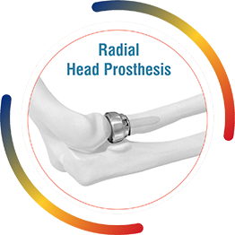 Radial Head Prosthesis