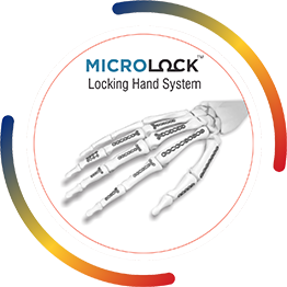 MICROLOCK Locking Hand System