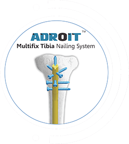 ADROIT Multifix Tibia Nailing System