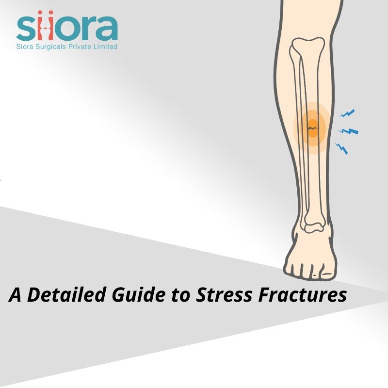A Detailed Guide to Stress Fractures