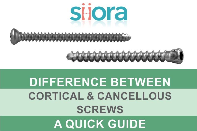 Difference Between Cortical and Cancellous Screws