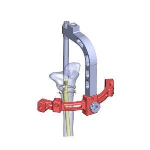 SupraPatellar