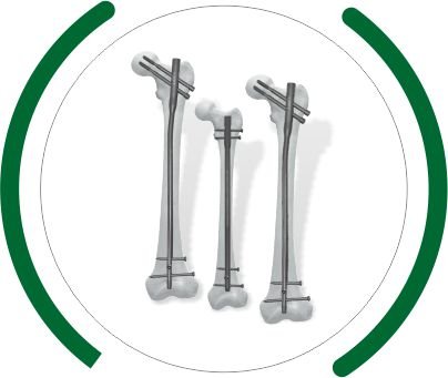 ADROIT - AFN Nailing System