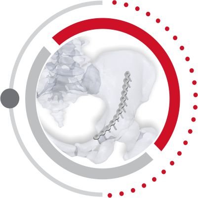 Low Profile PELVIS Plating System