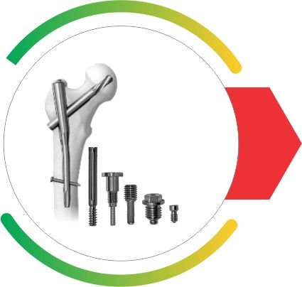 PROXAFIX PFNA Nailing System