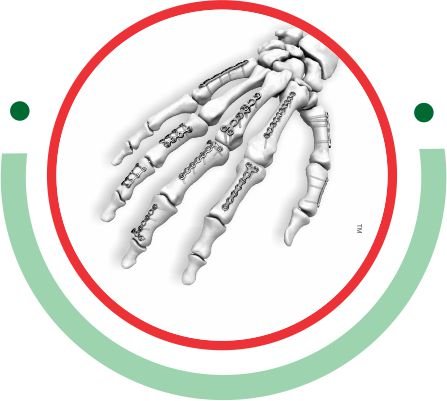 MICROLOCK Locking Hand System