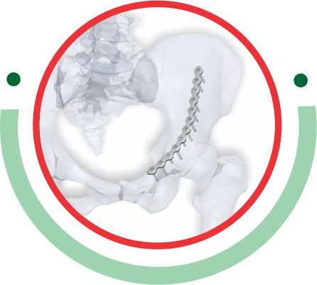 Low Profile PELVIS Plating System