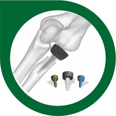 Radial Head Prosthesis