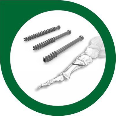 Cannulated Screw