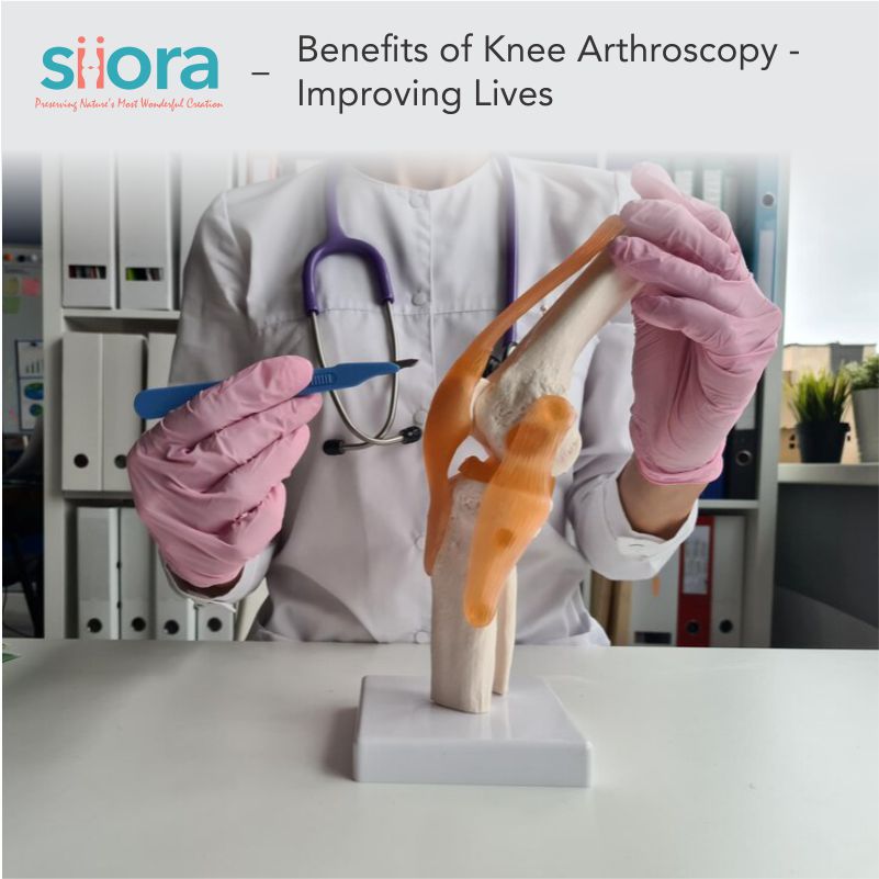 Read more about the article Benefits of Knee Arthroscopy – Improving Lives