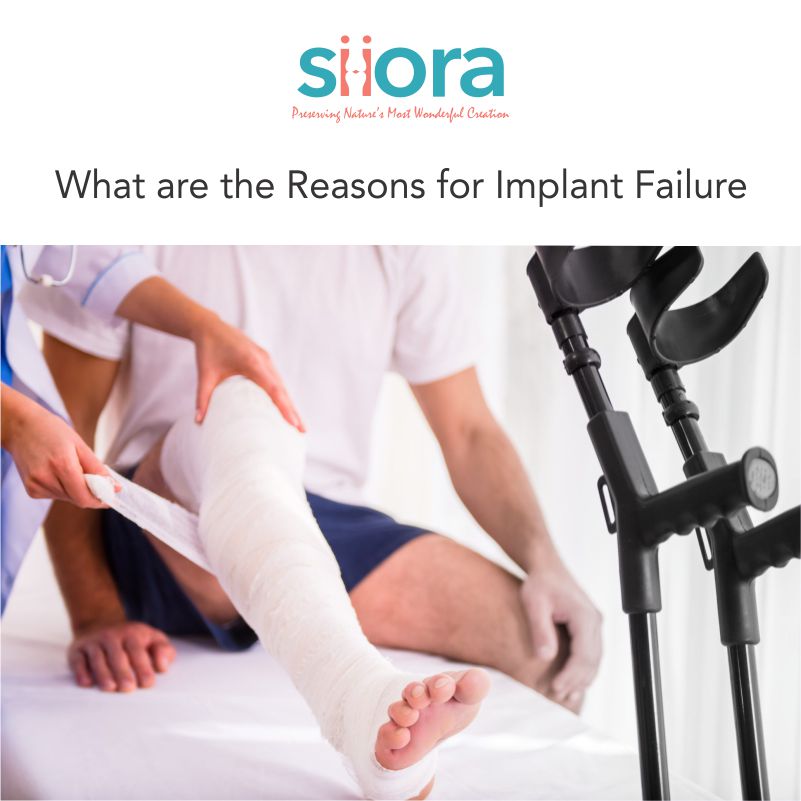 Read more about the article What Are the Reasons for Implant Failure?