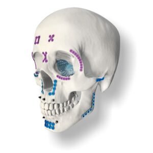 Maxillofacial Internal Fixation System