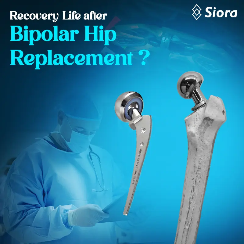 Recovery Roadmap Life After Bipolar Hip Replacement Surgery