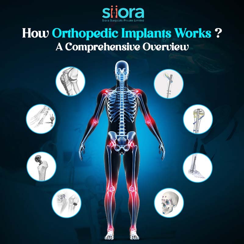how orthopedic implants work
