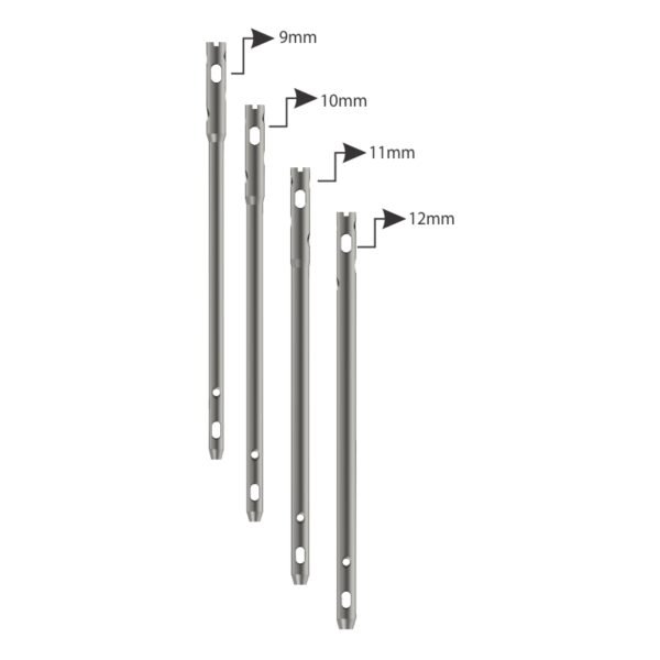 Ankle Arthrodesis Nail