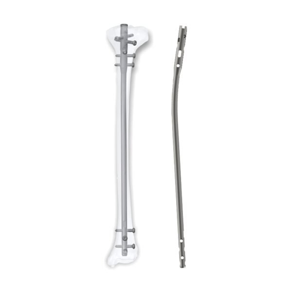 Expert Tibia Nail – Titanium