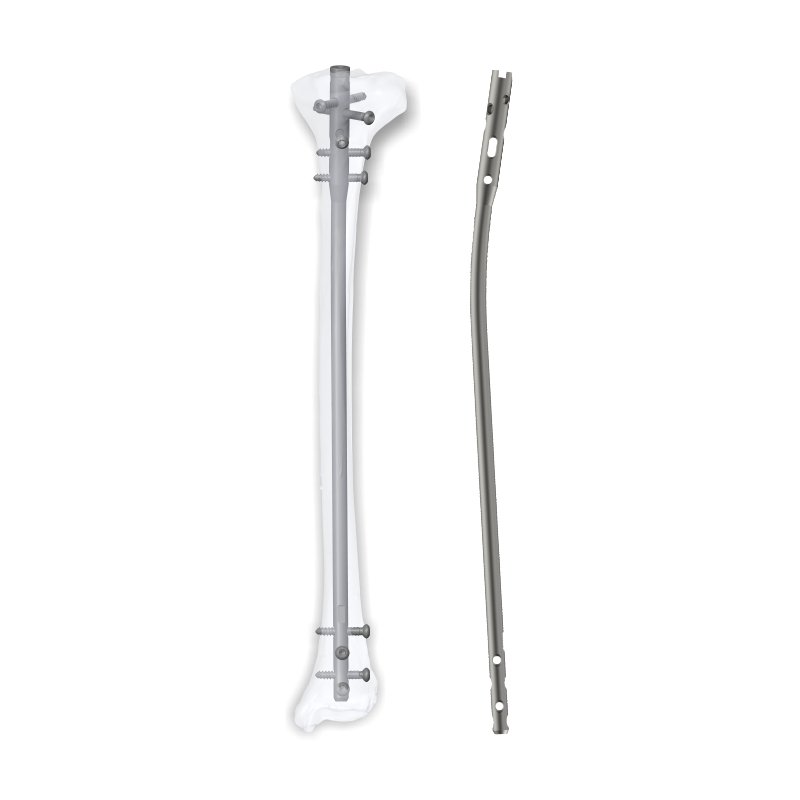 Expert Tibia Nail – Titanium