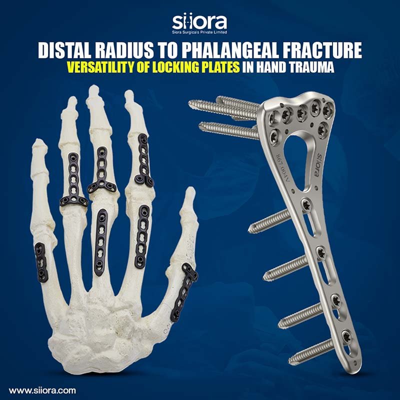 versatility of locking plates in hand trauma
