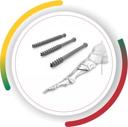 CANNULATED Lithuania