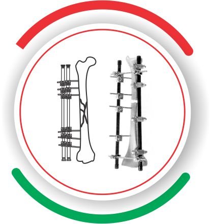 EXTERNAL FIXATOR lebanon