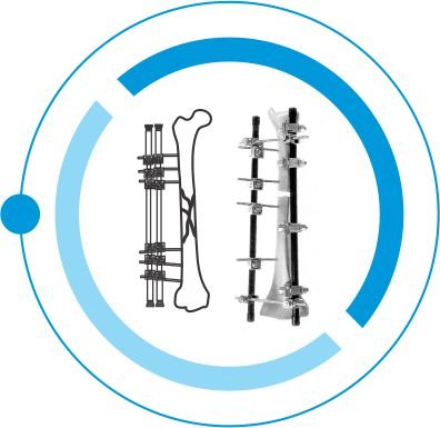 EXTERNAL FIXATOR tanzania