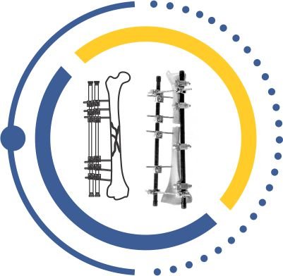 EXTERNAL FIXATOR ukraine